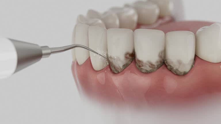 Trusted Teeth Cleaning And Checkup service in Copperopolis, CA - Dentist Open Now